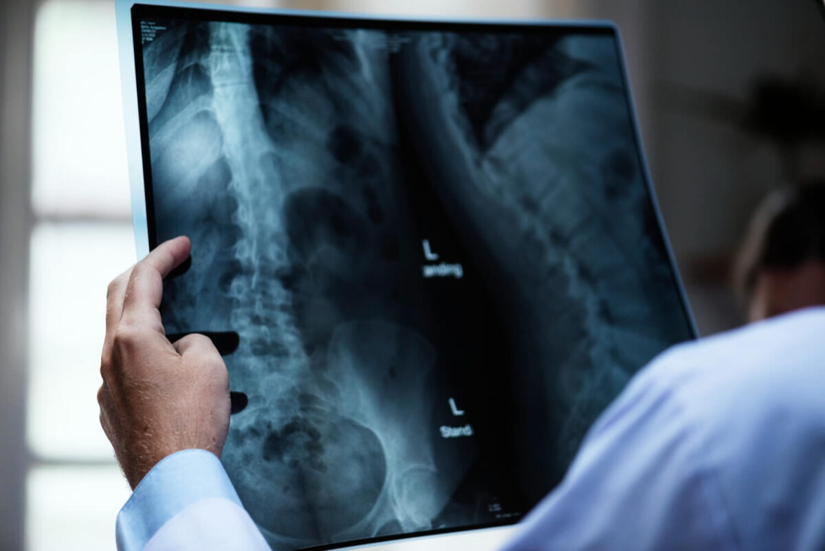 9-May-Pain-Management-for-Back-Pain-1200x801.jpg