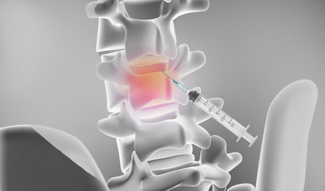 12-June-Injection-for-Back-or-Nerve-Pain_Banner.jpg